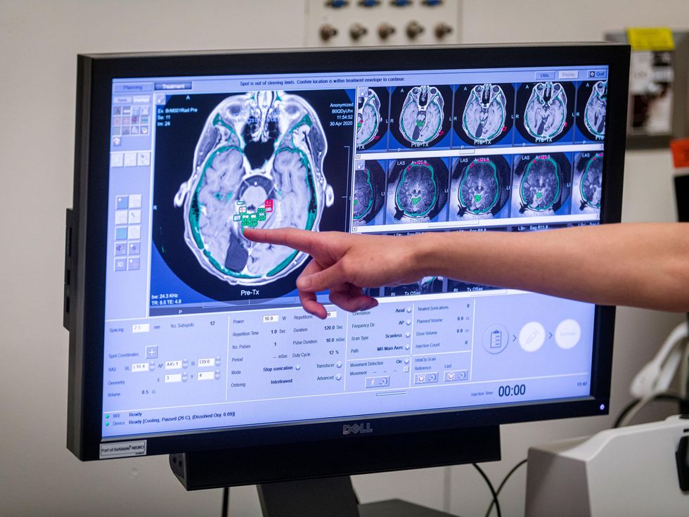 finger pointing to black and white brain scan on computer screen