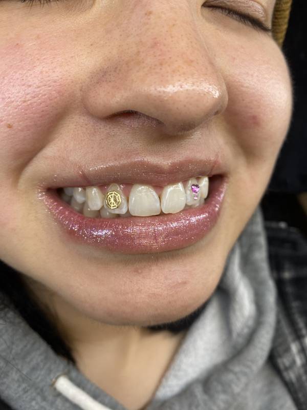 Briana Neurohr, of Tinley Park, shows off the two tooth gems she received a few months ago from cosmetologist Libby Kerfman.