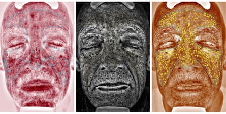 Phil Daoust’s scans, showing, from left, redness, UV spots and brown spots.