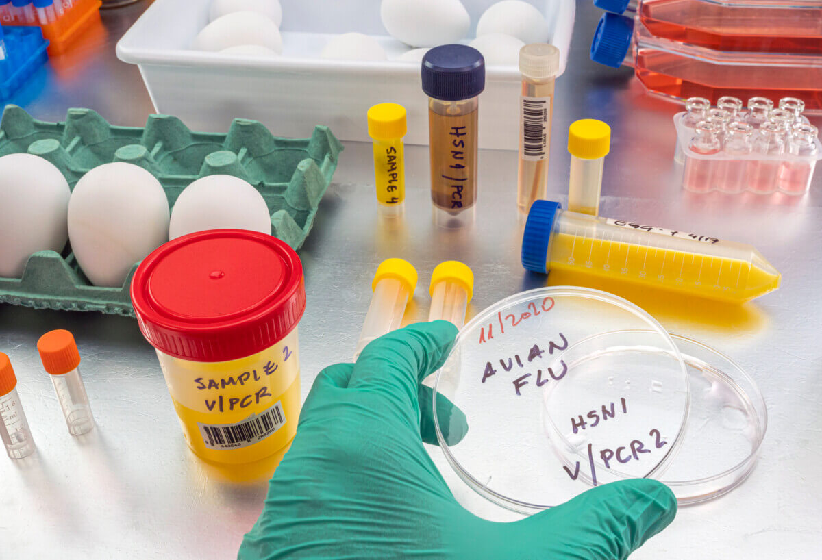 Lab tests for avian influenza (bird flu) strain H5N1