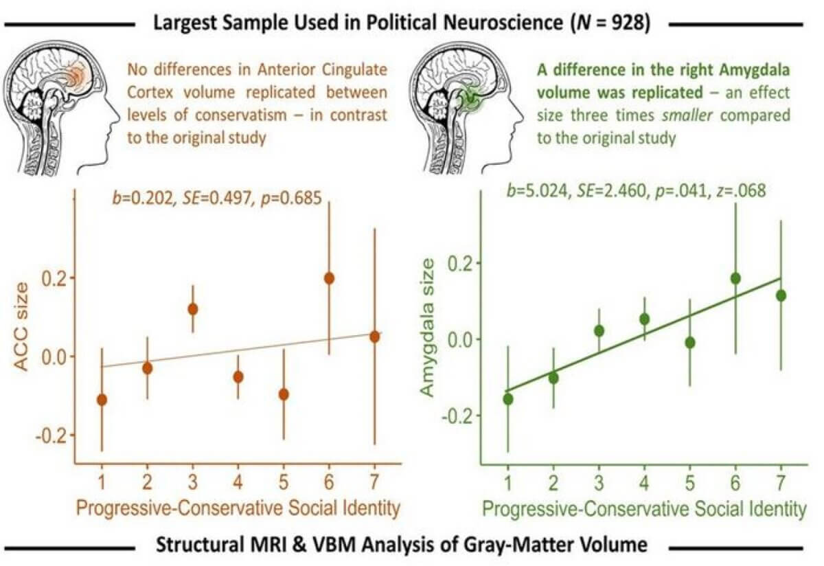 brain structure of conservatives